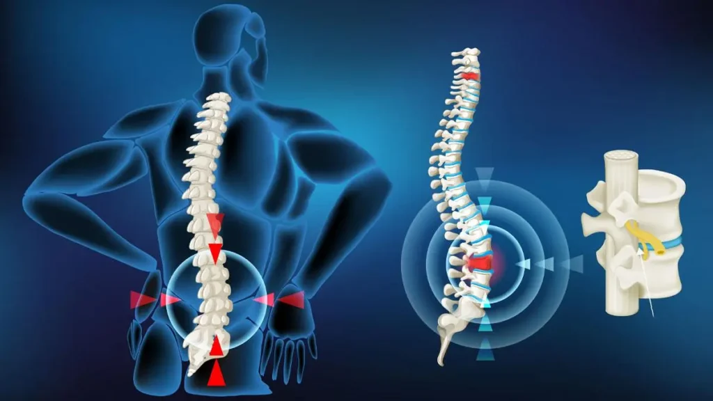 5 Signs You Should See an Orthopedic Spine Specialist
