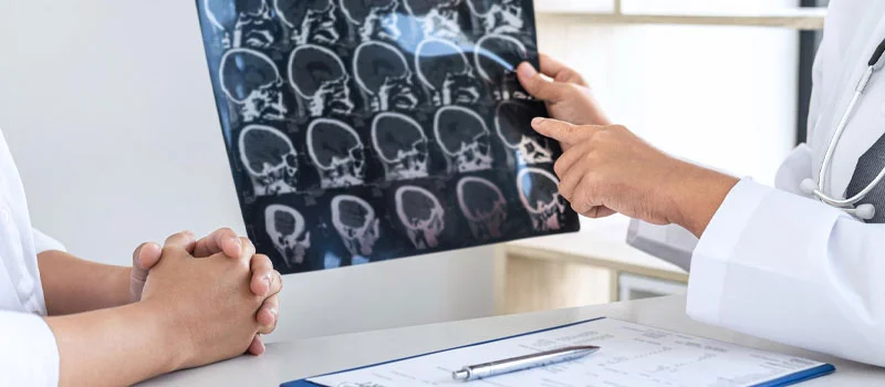 Best Neurologist in Chandigarh