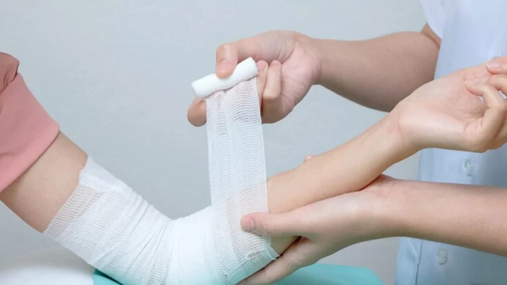 Fracture First Aid: Immediate Steps to Take